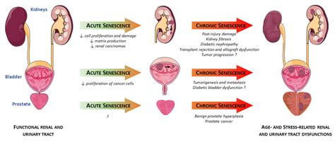 Cells Free Full Text Cellular Senescence In Renal And Urinary Tract