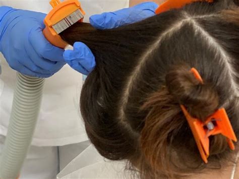 How Do Salons Remove Lice From Hair Permanently? – My Blog