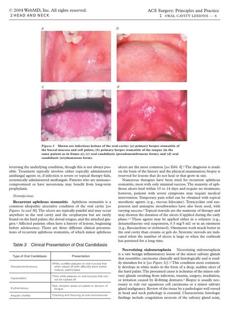 Acs0201 Oral Cavity Lesions