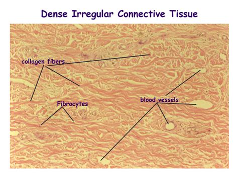 Dense Regular Connective Tissue Labeled