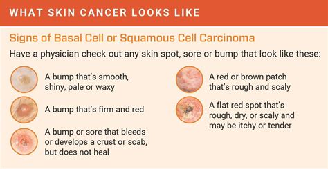 What Does Skin Cancer Look Like A Visual Guide To Warning Signs My