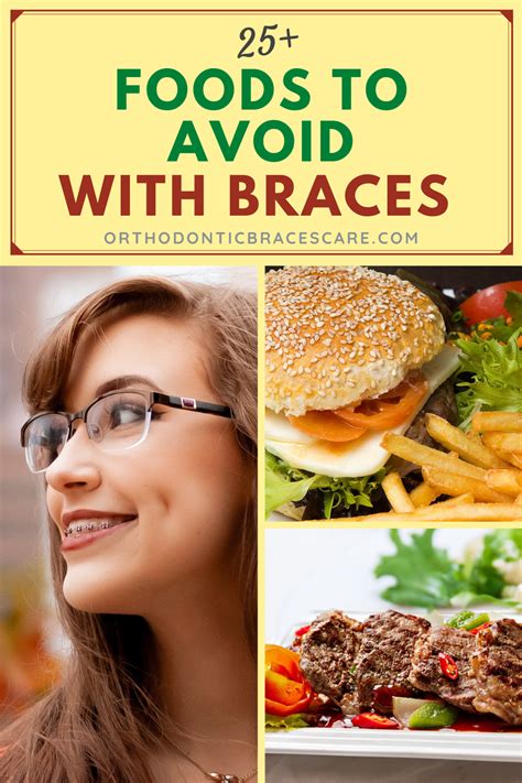 25 Foods To Avoid With Braces Foods To Avoid Braces Food Food