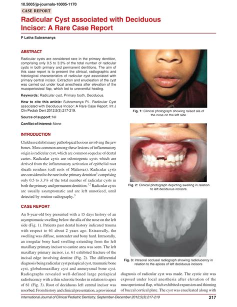 pdf radicular cyst associated with deciduous incisor a rare case report my xxx hot girl