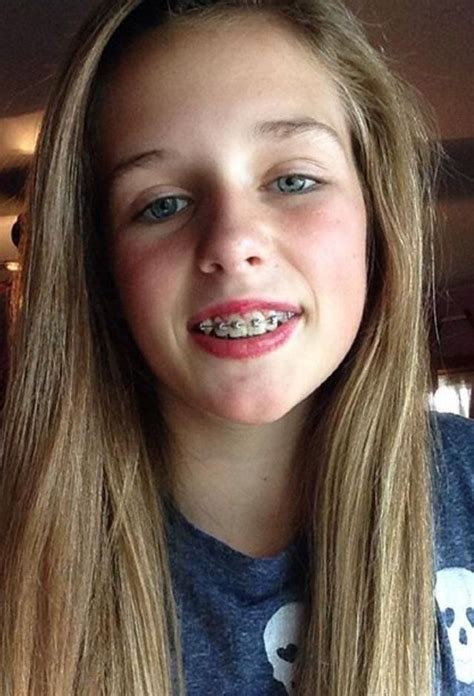 '15 way too old imo (in my opinion). Pin by Marilynn Wrigley on Novel in 2020 | Cute braces ...