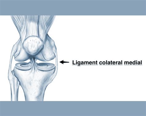 Leziuni De Ligament Colateral Medial Chirurgia Genunchiului