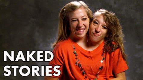 Two Conjoined Twins Explain How They Drive Conjoined Twins Twins Really Funny Pictures