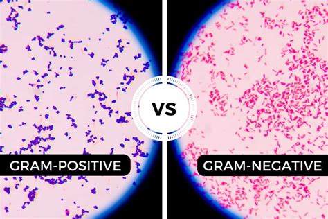 Gram Negative And Gram Positive Bacteria