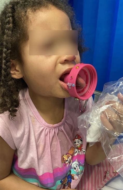 Girl 5 Rushed To Hospital With Her Tongue Stuck In A Water Bottle