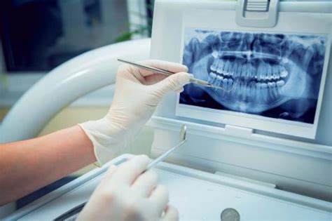 RadiologÍa Dental Carval Formación