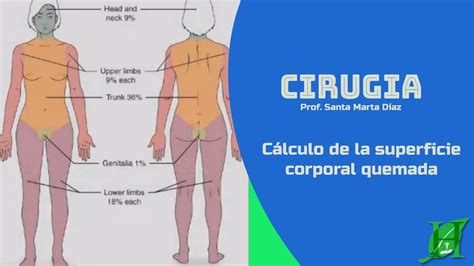 Calculo De La Superficie Corporal Quemada Youtube