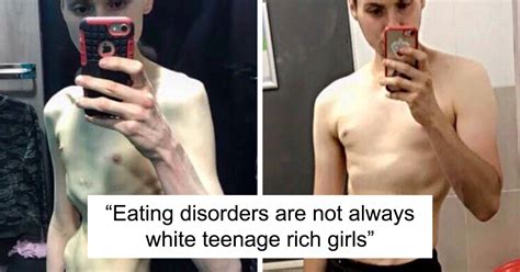 tumblr users explain how men can have anorexia too after someone begins doubting one man s