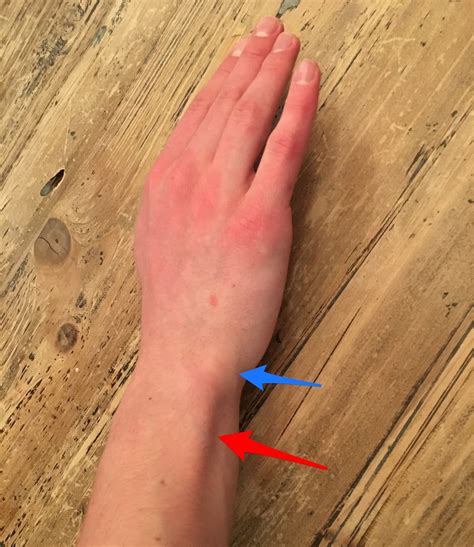 Young Athlete Center Wrist Pain In Baseball