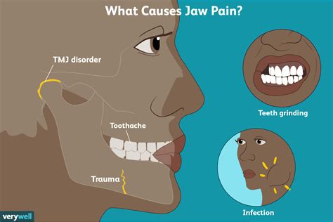 Earache And Jaw Pain When Chewing Herbs And Food Recipes