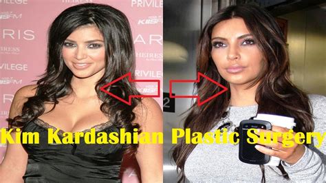 Kim Kardashian Plastic Surgery Before And After Youtube