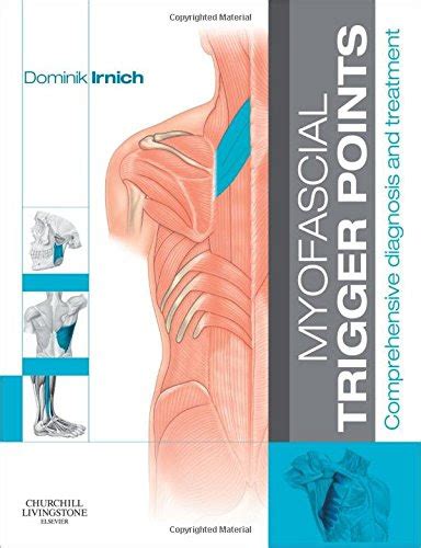 Tofmouth D608ebook Ebook Myofascial Trigger Points Comprehensive Diagnosis And Treatment