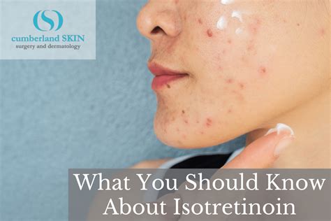 What You Should Know About Isotretinoin Cumberland Skin