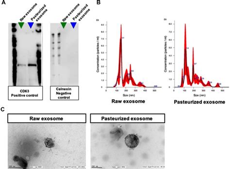 Characterization Of HBM Exosomes A Western Blot Showed Positive CD63