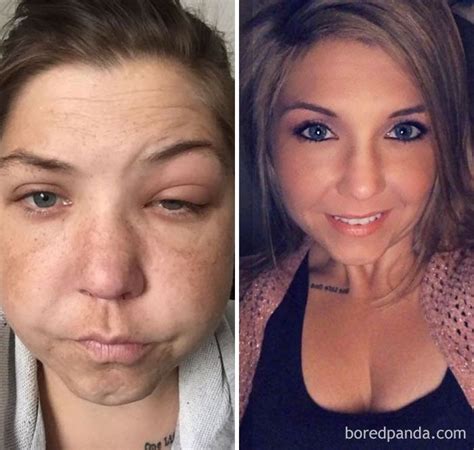 Stunning Before After Transformations Of People Who Quit Drugs Artofit