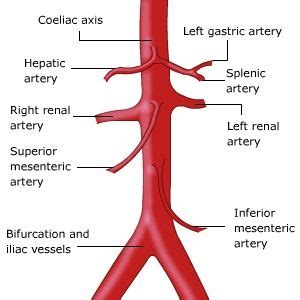 Branches of abdominal aorta simply explained. branches of abdominal aorta - Google Search | Vascular ...