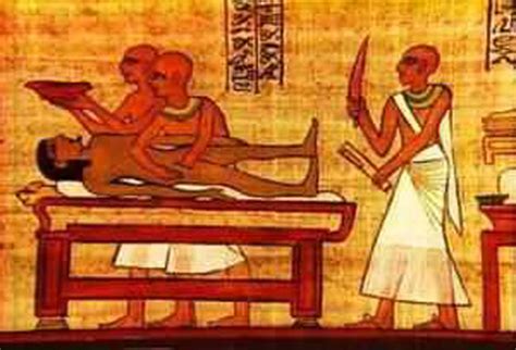 Медицина в древнем Египте Обсуждение на Liveinternet Российский Сервис Онлайн Дневников