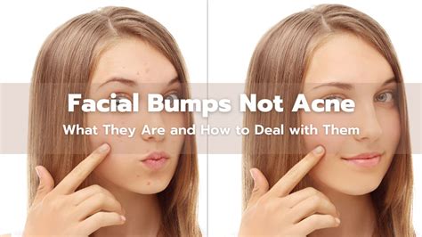 Facial Bumps Not Acne What They Are And How To Deal With Them