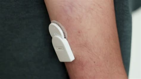 Freestyle libre and apple watch? Using the Freestyle Libre with Miaomiao to get realtime ...