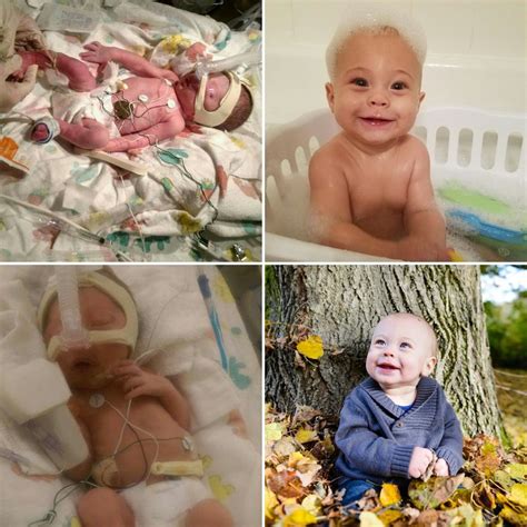 6 Month Premature Baby Images Newborn Baby