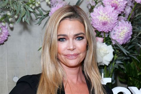 Denise Richards Claims Shes Never Used Botox Of Fillers