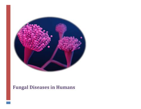 Solution Fungal Diseases In Humans Studypool