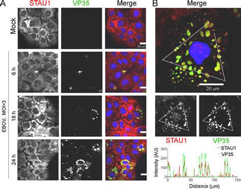 Stau1 Is Recruited To Viral Inclusion Bodies Upon Ebov Infection A