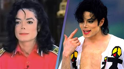 Michael Jackson Explained His Skin Disorder After Claims He Was