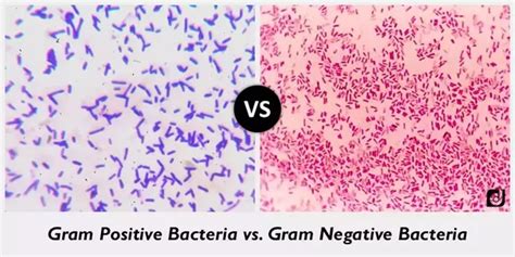 What Are Some Characteristics Of Gram Positive Bacteria Quora