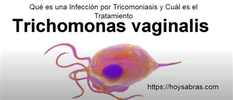 Qué Es Una Infección Por Tricomoniasis Y Cuál Es El Tratamiento 2024