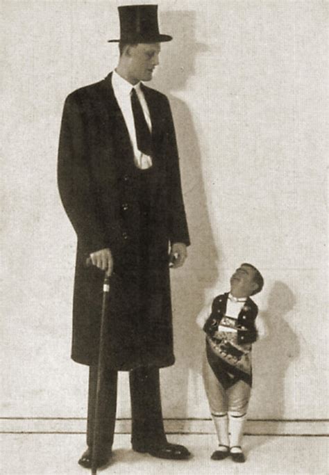 Gigantism And Dwarfism Kramer Photograph By Science Source Pixels