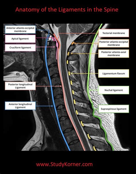 Low back pain chart 20x26. Spinal Anatomy: Ligaments, Tendons and Muscles - NCLEX Quiz