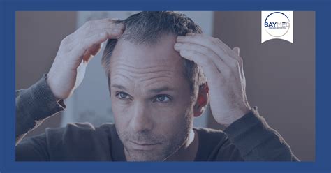 Top 3 Causes Of Hair Loss Baymed Hair And Aesthetics