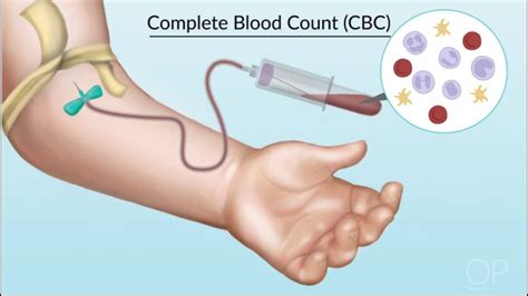Understanding Complete Blood Counts By Laura Stokes And Samantha