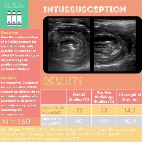 Ultrasound Gel A Pocus Protocol For Intussusception Laptrinhx News