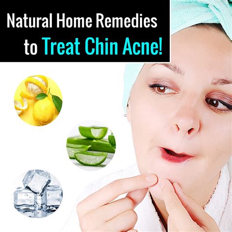 Chin Acne How To Treat Chin Acne With Natural Home Remedies