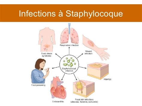 Cours 9 Infections