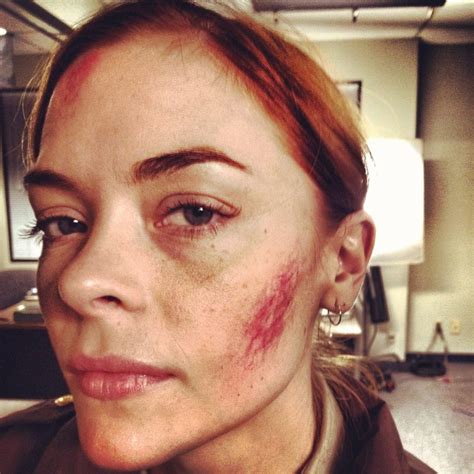 A Bruised Jaime King On The Set Of Silent Night Bloody Disgusting