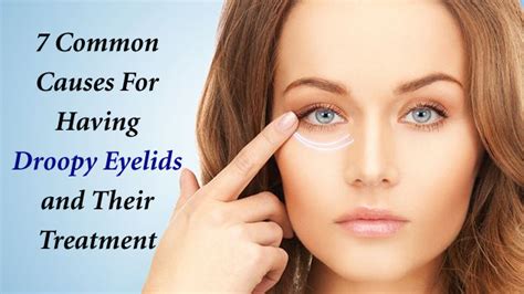 7 Common Causes For Having Droopy Eyelids And Their Treatment 2023
