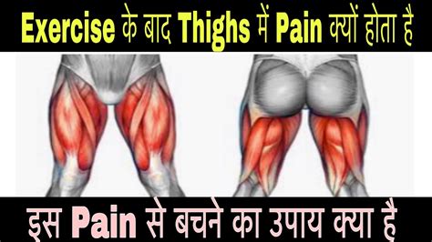 Thigh Muscles Painsoreness After Exercise And How To Relieve From That
