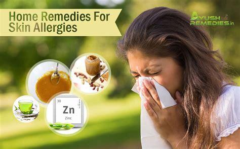 7 Best Home Remedies For Skin Allergies Get Marvellous Results