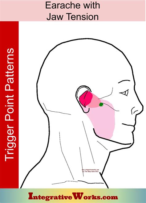 Earache With Jaw Tension Integrative Works