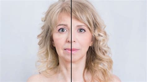 How Botox Eliminates More Than Just Wrinkles Miosuperhealth