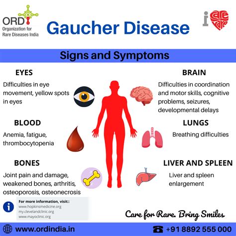 Gaucher Disease مرض