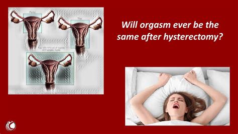 Will Orgasm Ever Be The Same After Hysterectomy For Uterine Prolapse