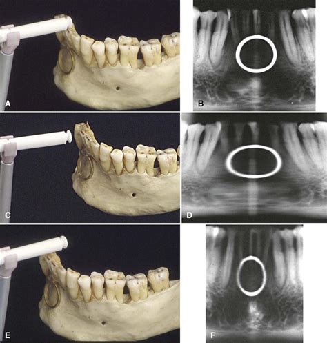 10 Panoramic Imaging Pocket Dentistry