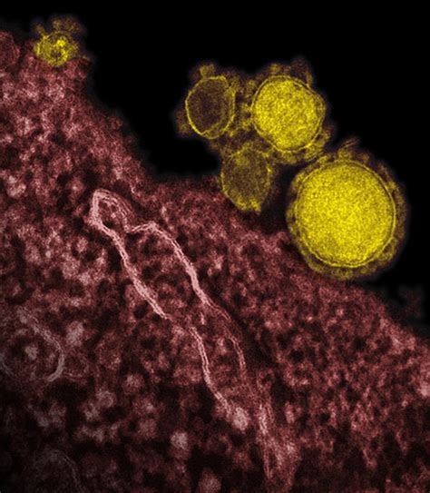 Investigation Follows Trail Of A Virus In Hospitals The New York Times